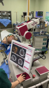 哈医大一院神外团队完成省内首例ROSA机器人脑深部电刺激手术治疗肌张力障碍